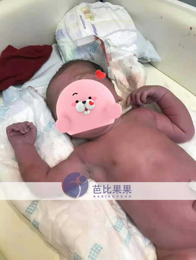 L女士在乌克兰马丽塔试管包成功健康出生的男宝宝