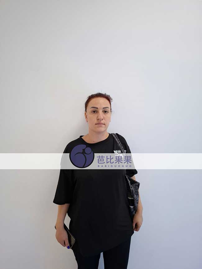 黄先生到格鲁吉亚匹配的试管妈妈来医院做B超