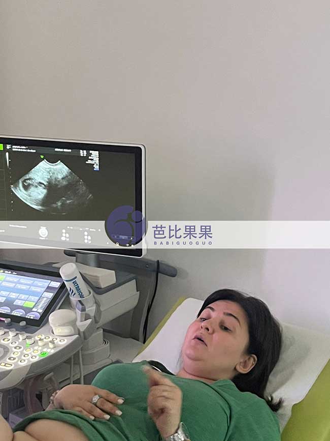 叶女士夫妇在格鲁吉亚自卵促排匹配的试管妈妈做第二次B超