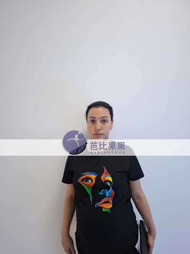 王先生和郭先生到格鲁吉亚匹配的试管妈妈来医院做B超