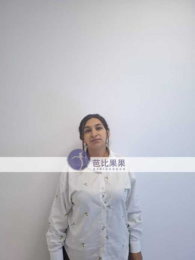 黄先生到格鲁吉亚匹配的试管妈妈按时配合来医院做孕32周B超