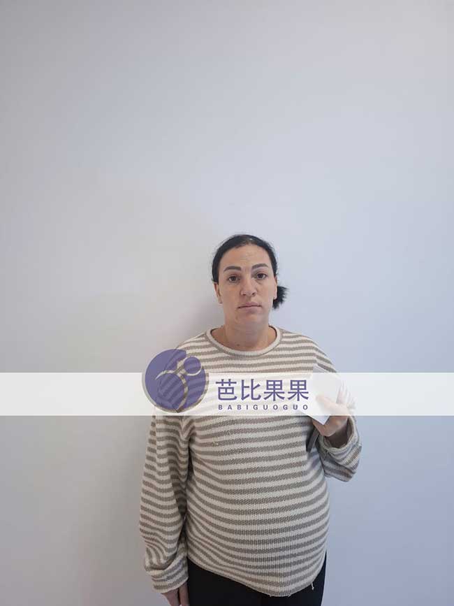 龚先生夫妇到格鲁吉亚匹配的试管妈妈来医院做B超