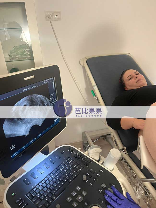 试管妈妈首次B超