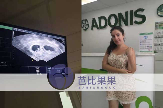 由英国产科医生帕特里克·斯特普托和生理学家罗伯特·爱德华兹合作研