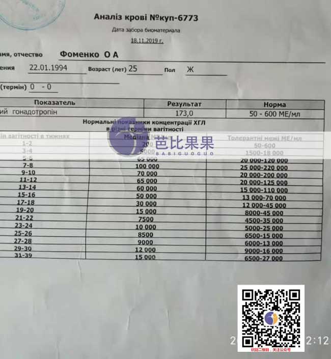 H姐的乌克兰SGM一次移植验孕成功 连接验孕都是成功