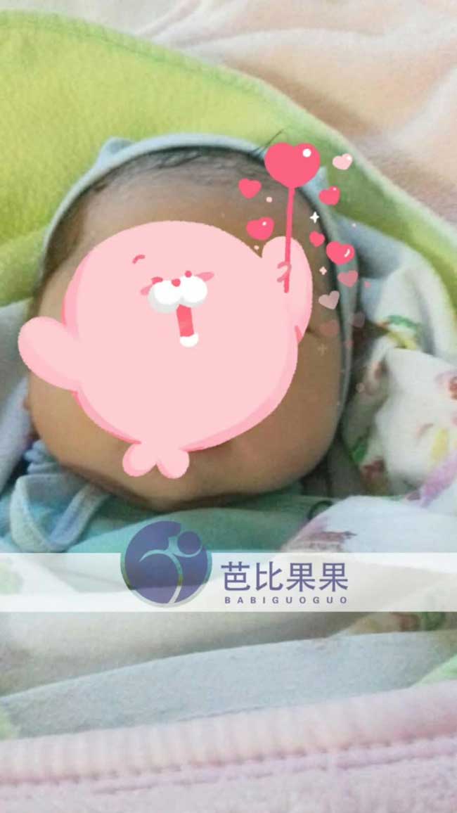 W女士在乌克兰彼奥医院做自卵试管所得的女宝宝顺利出生