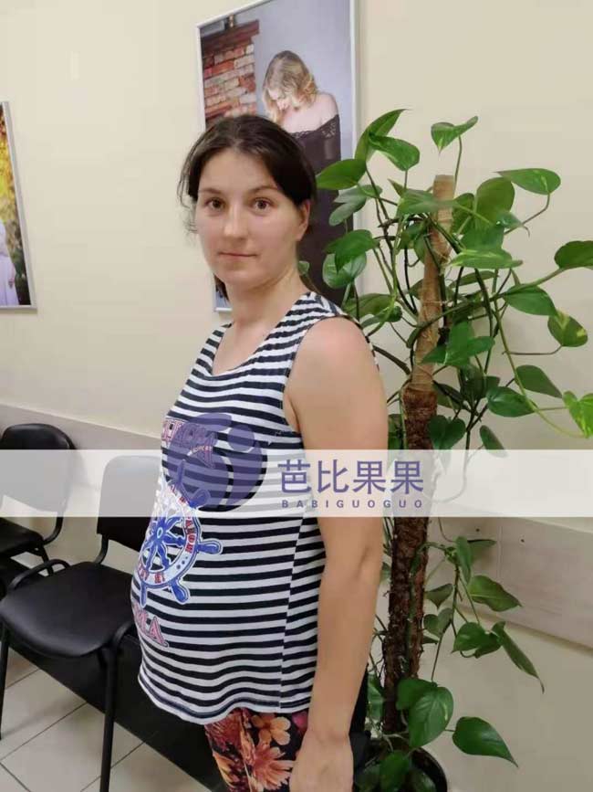 Q先生家的乌克兰试管怀孕25周来做四维彩超