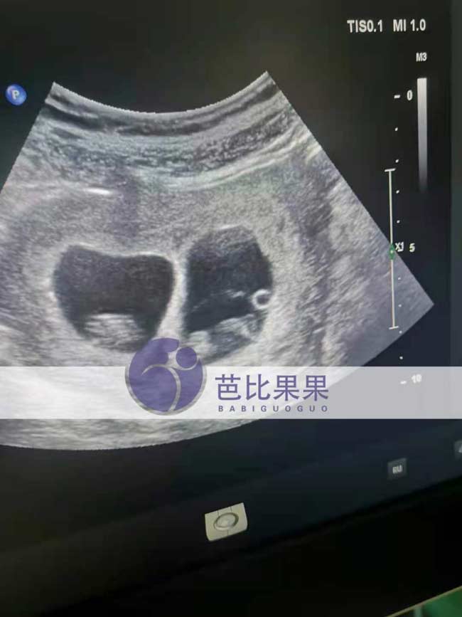 乌克兰孕妈做产检