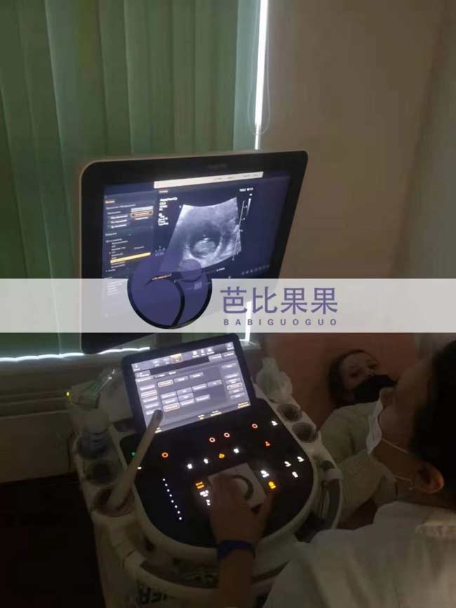 乌克兰孕妈B超检查