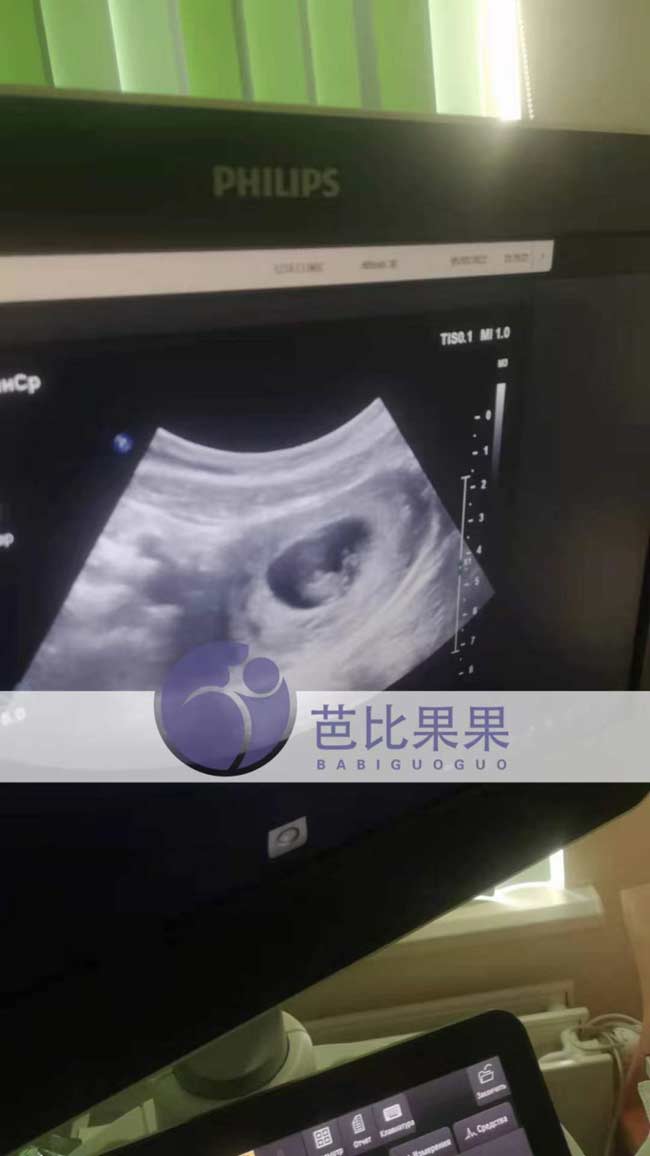 乌克兰孕妈做产检