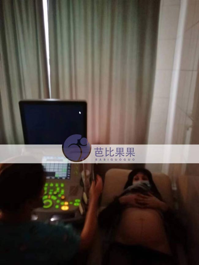 Z女士已经到孕后期的乌克兰试管妈妈来医院做33周B超