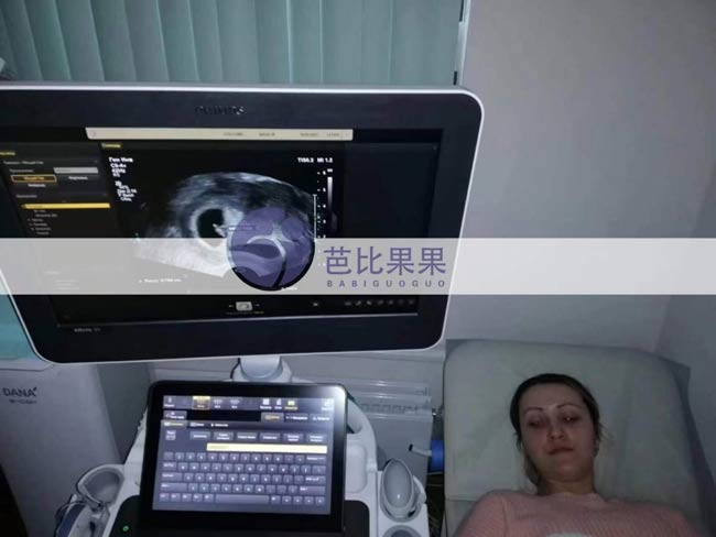 C女士家的乌克兰试管妈妈按时到妇产医院做b超检查