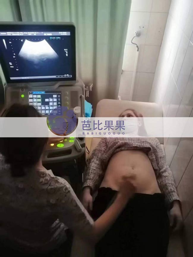 乌克兰试管妈妈孕12周产检