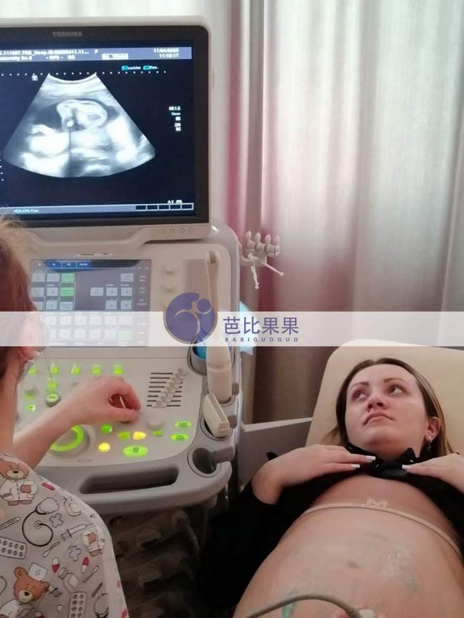 C女士家的乌克兰试管妈妈来妇产医院做孕18周孕检