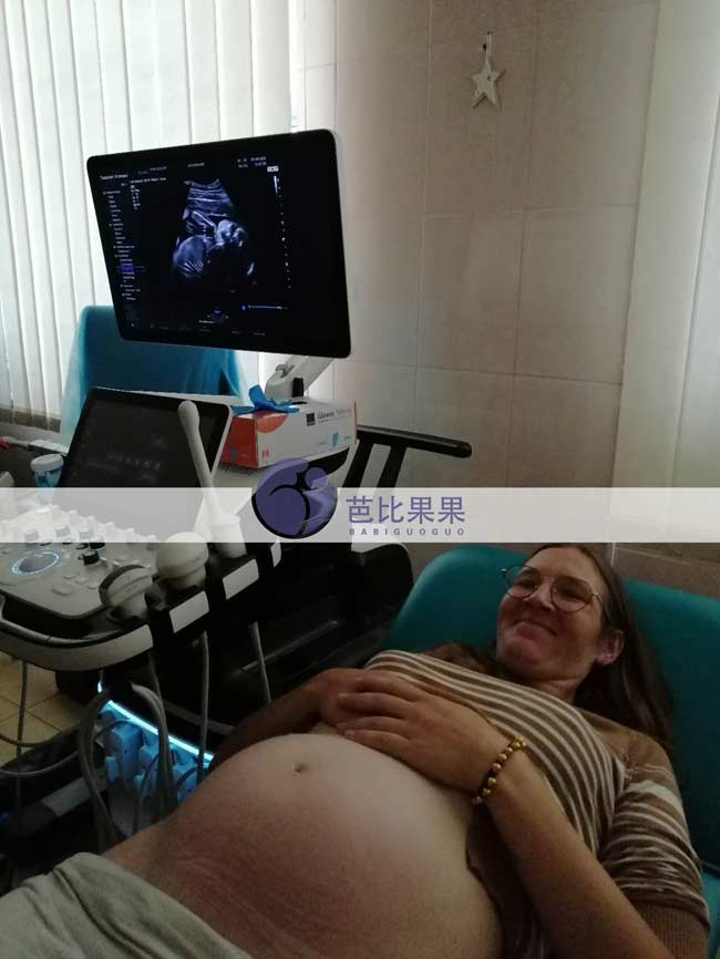 新疆Z女士家的乌克兰试管妈妈按时来做孕23周+B超检查