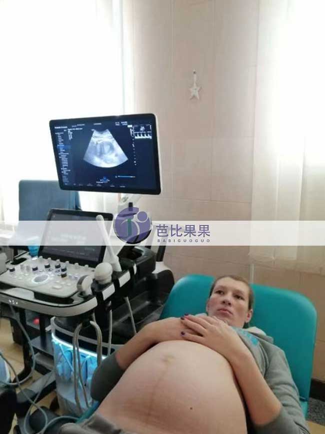 乌克兰试管妈妈做四维彩超