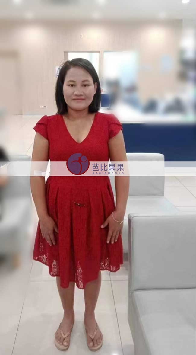 Z女士家的泰国试管妈妈来做孕24周四维彩超，胎儿长得很好