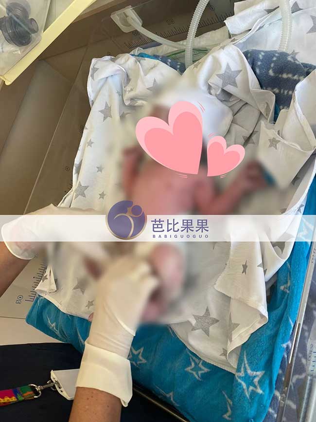 Y女士在格鲁吉亚自卵DY的试管女宝宝体重3180克，身高50厘米