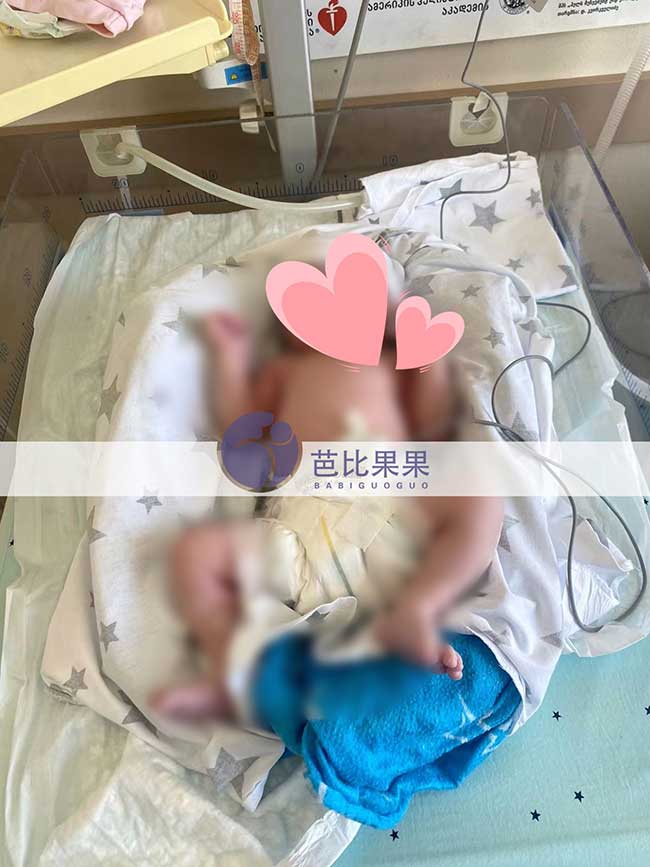 格鲁吉亚试管女宝宝出生