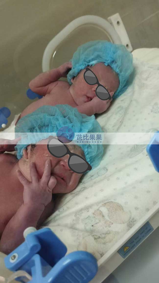 北京梁女士夫妇到格鲁吉亚试管助孕的龙凤胎宝宝顺利出生
