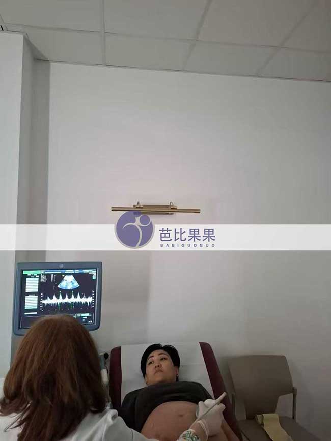 试管妈妈做四维彩超