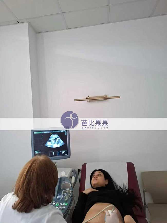 试管妈妈做四维彩超