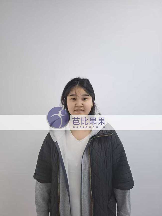 芭比果果三个家庭到格鲁吉亚匹配的试管妈妈做四维彩超