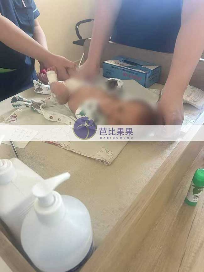 试管宝宝做亲子鉴定