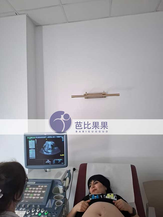试管妈妈做B超