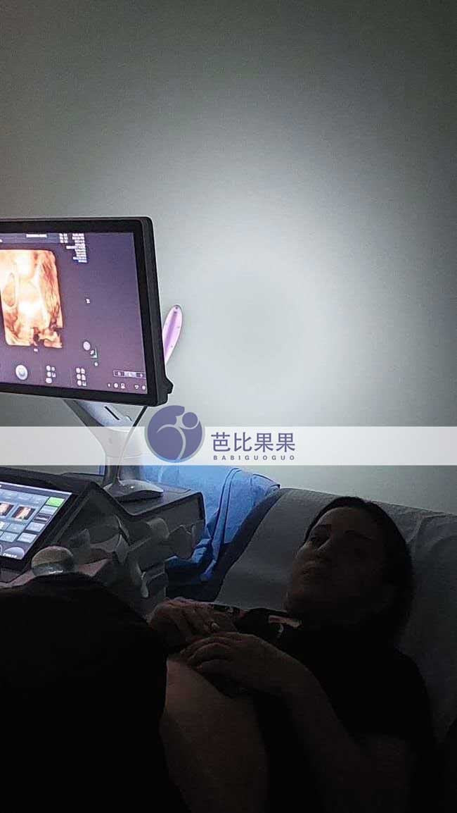 试管妈妈做B超