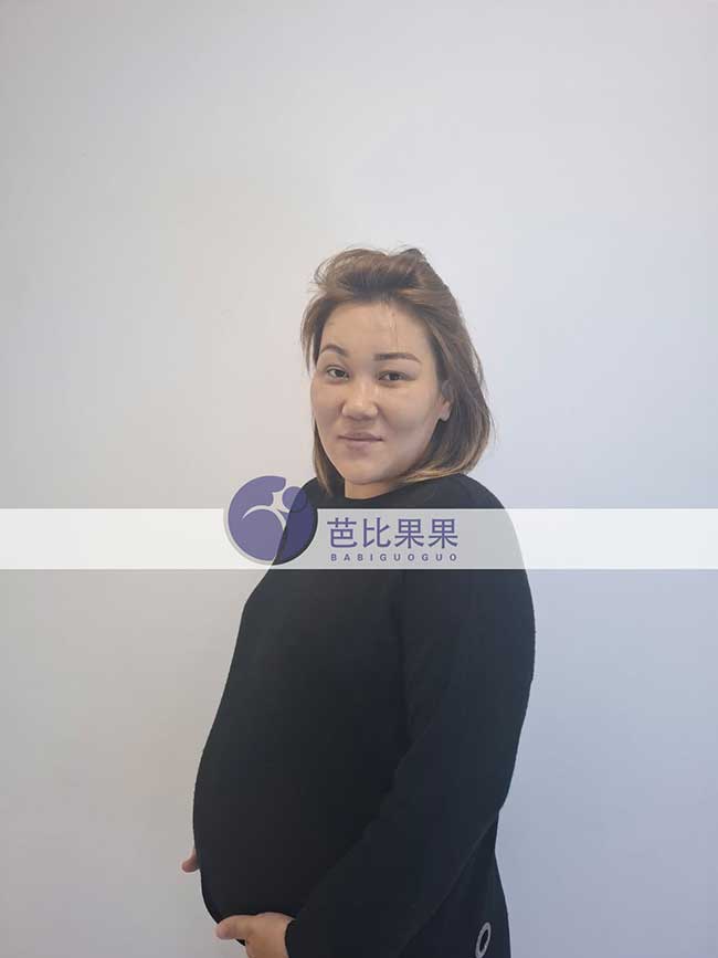 试管妈妈做B超
