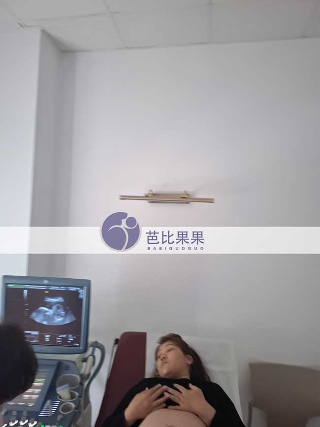 试管妈妈做B超