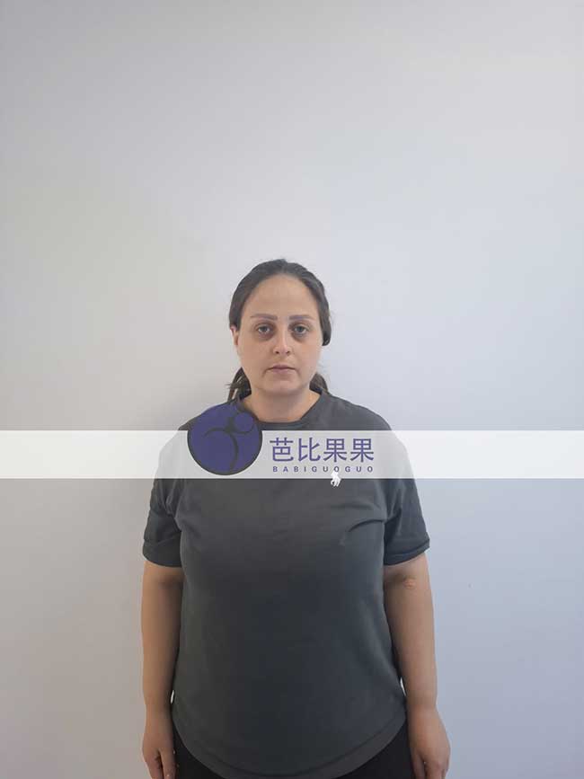 试管妈妈做B超