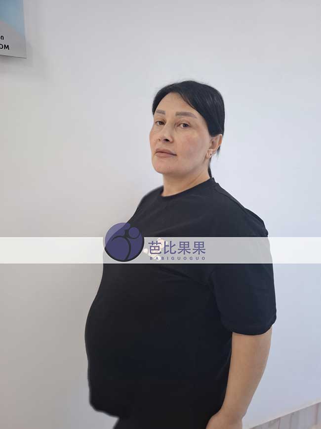 试管妈妈做B超