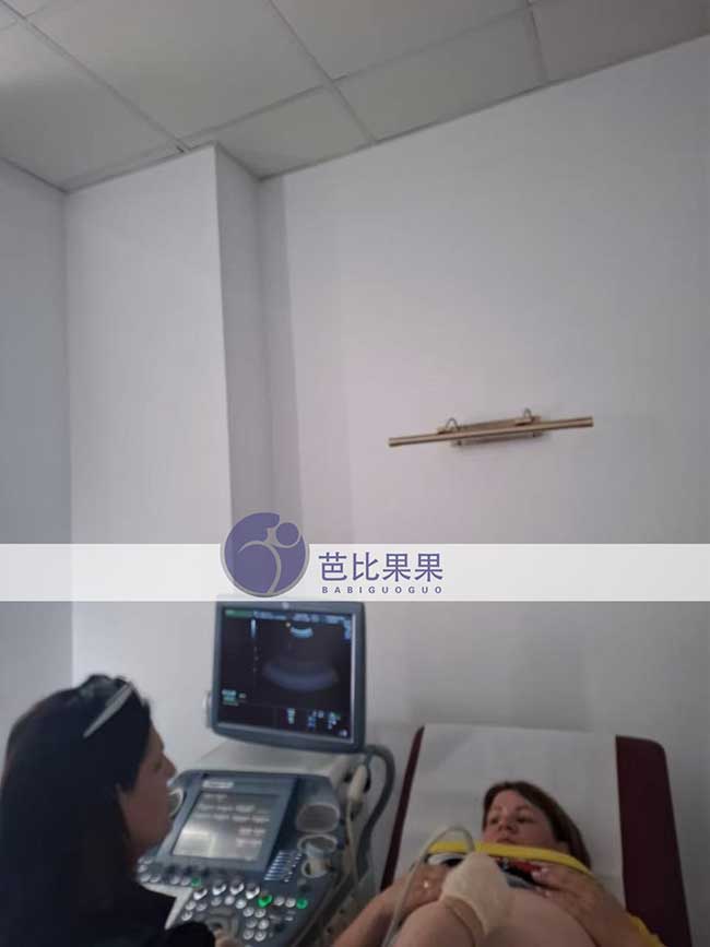 孕后期试管妈妈做B超