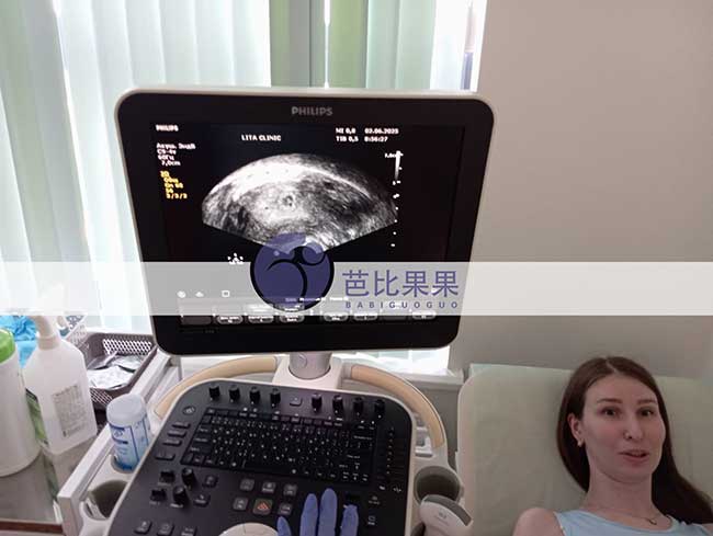 试管妈妈做B超