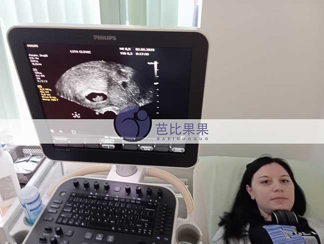 试管妈妈做B超