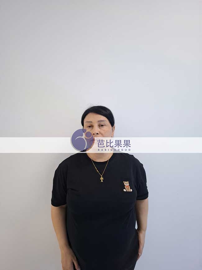 试管妈妈做B超