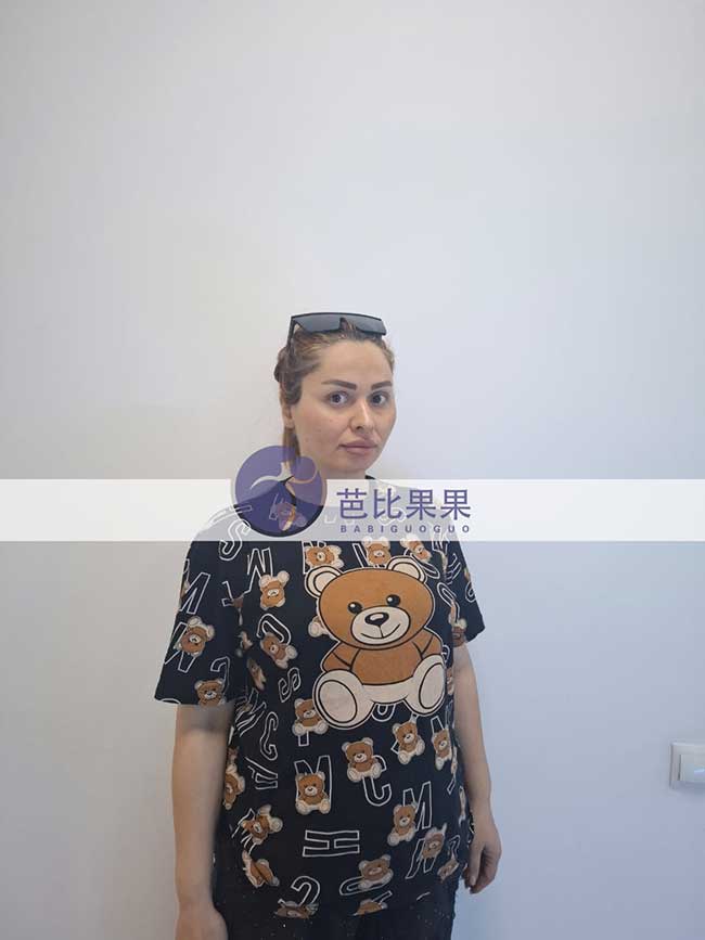 试管妈妈做四维彩超