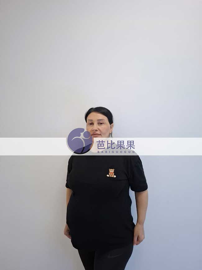 洪先生到格鲁吉亚匹配的试管妈妈怀上双胞胎来医院做B超