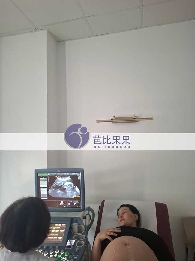 试管妈妈做B超