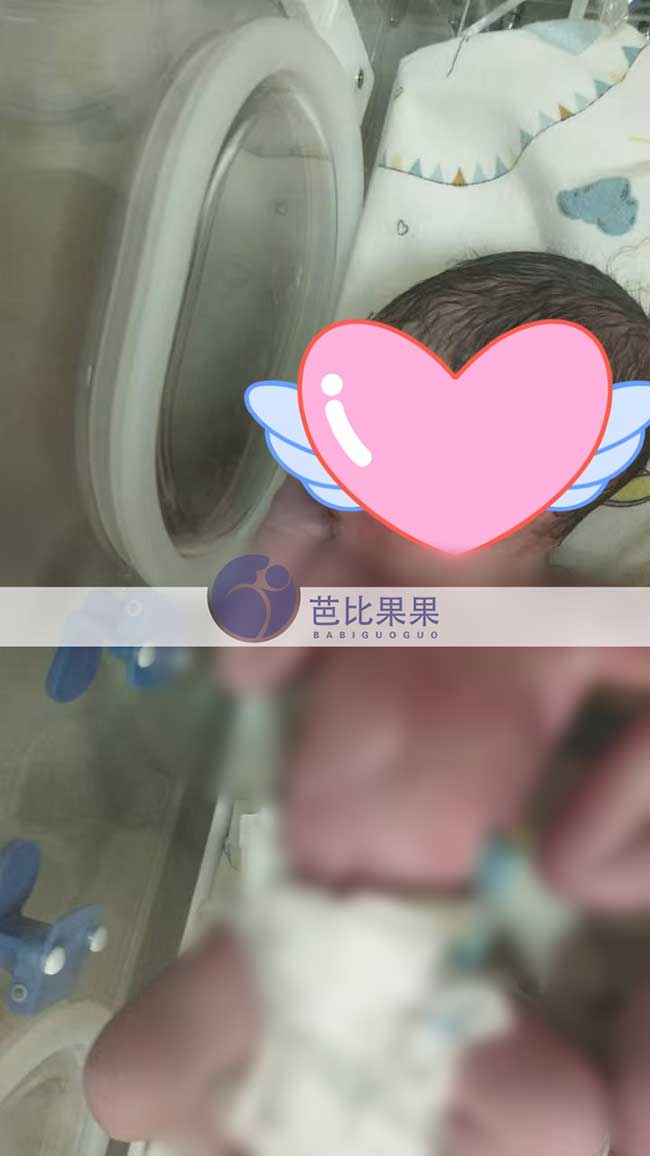 试管宝宝出生