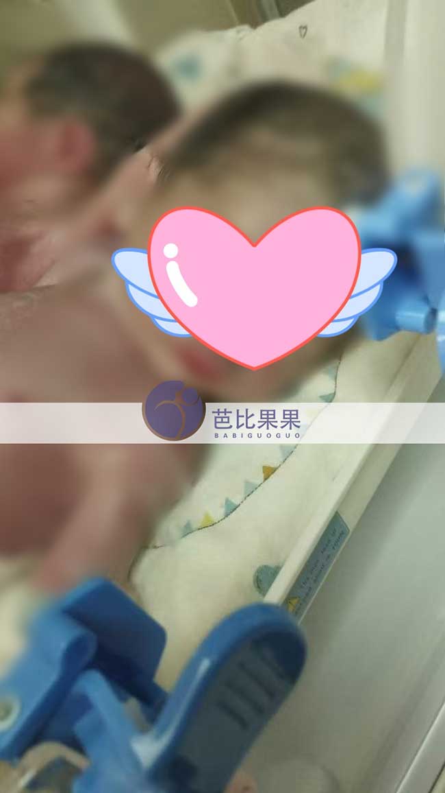 试管宝宝出生