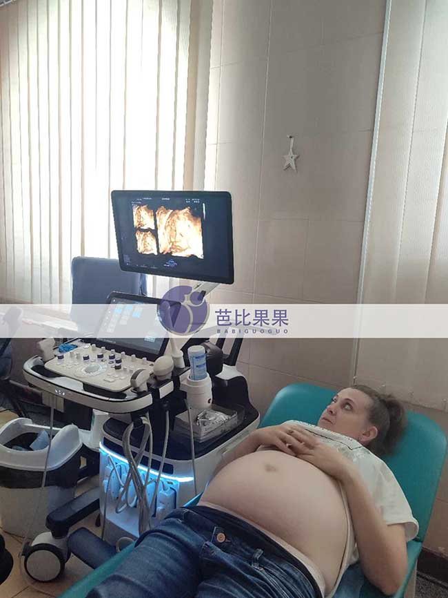 试管妈妈做四维彩超
