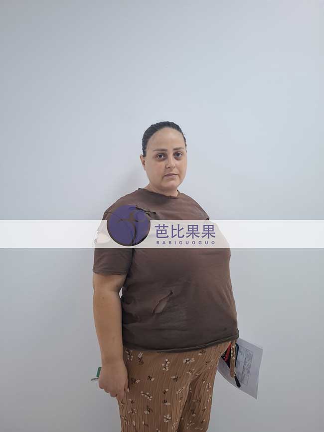 两个家庭到格鲁吉亚匹配的试管妈妈做孕33周/孕29周B超