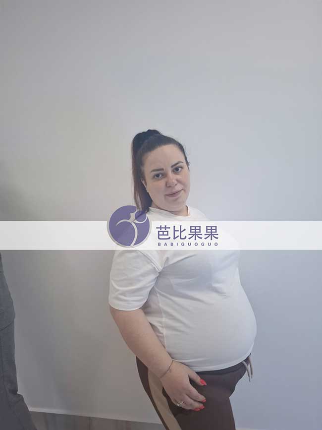 宋先生到格鲁吉亚匹配的试管妈妈做B超检查报告数据正常