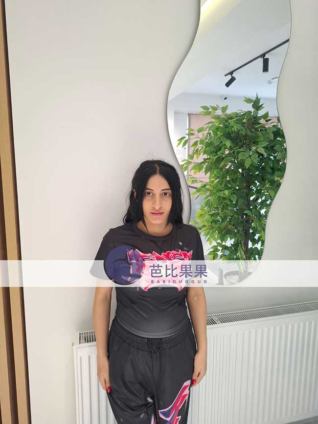 戴先生到格鲁吉亚匹配的试管妈妈完成重要的四维彩超检查