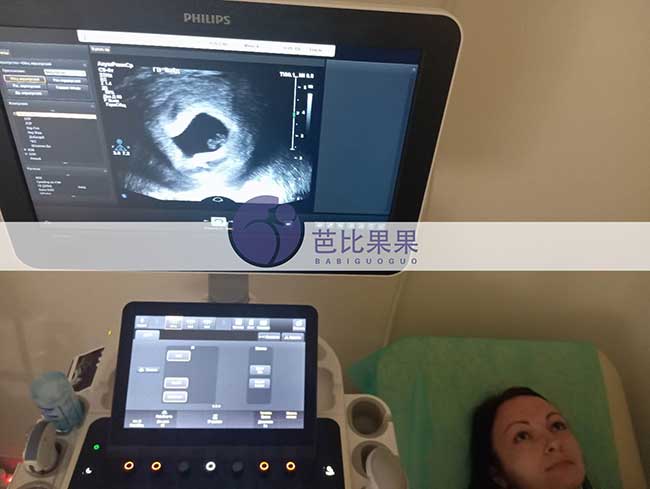 乌克兰试管二胎进展:廖先生家庭首次B超顺利通过
