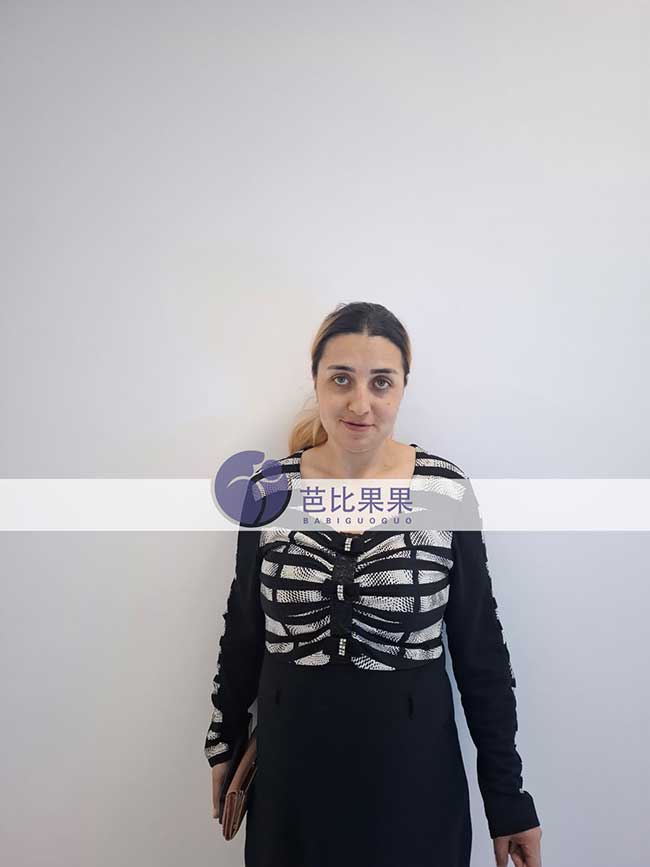 格鲁吉亚试管孕期进展更新:孔先生家庭B超复查顺利通过