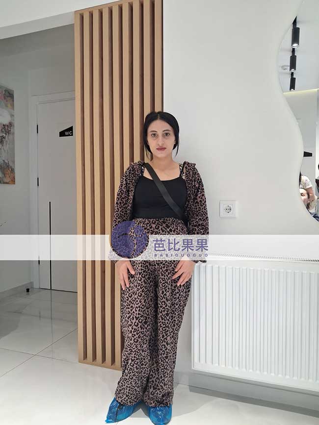 格鲁吉亚试管家庭迎来新进展,两位宝宝B超检查顺利通过